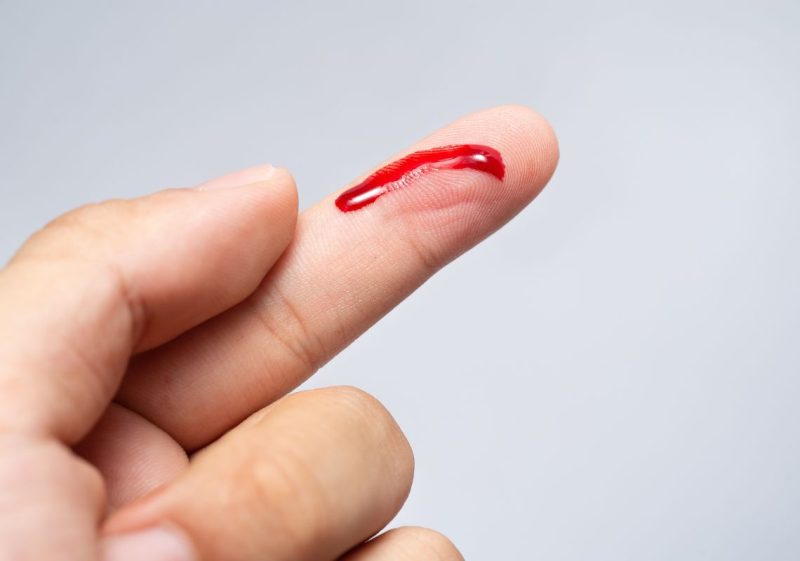 mơ thấy máu kinh nguyệt