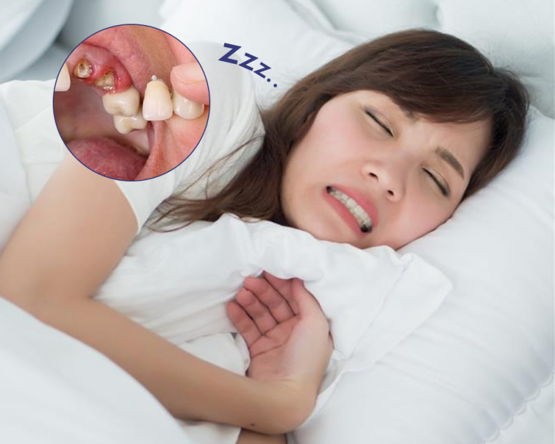 chiêm bao thấy rụng răng