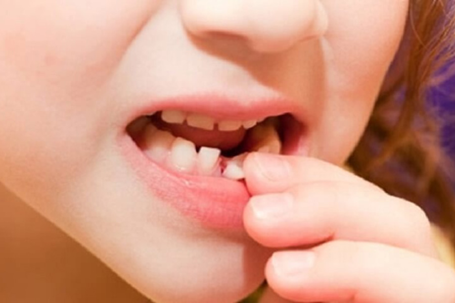 nằm mơ thấy nhổ răng điềm gì